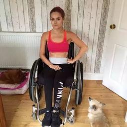 截肢女明星,逆境中的坚韧与美丽